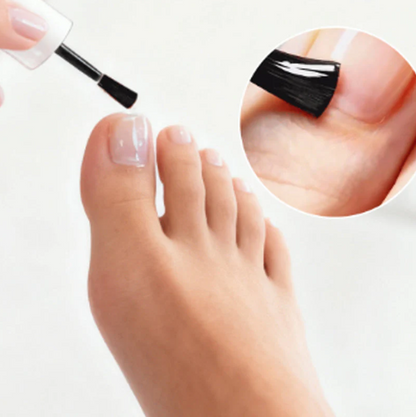 Last Day Of Discount 🔥 Nail Repair & Antifungal Solution